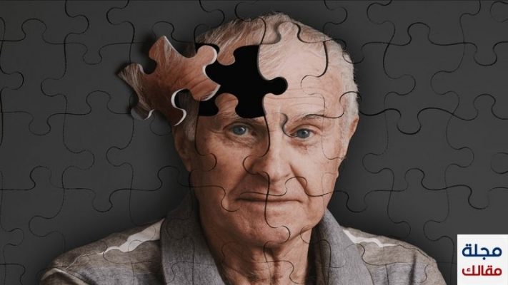 علاج ضعف الذاكرة